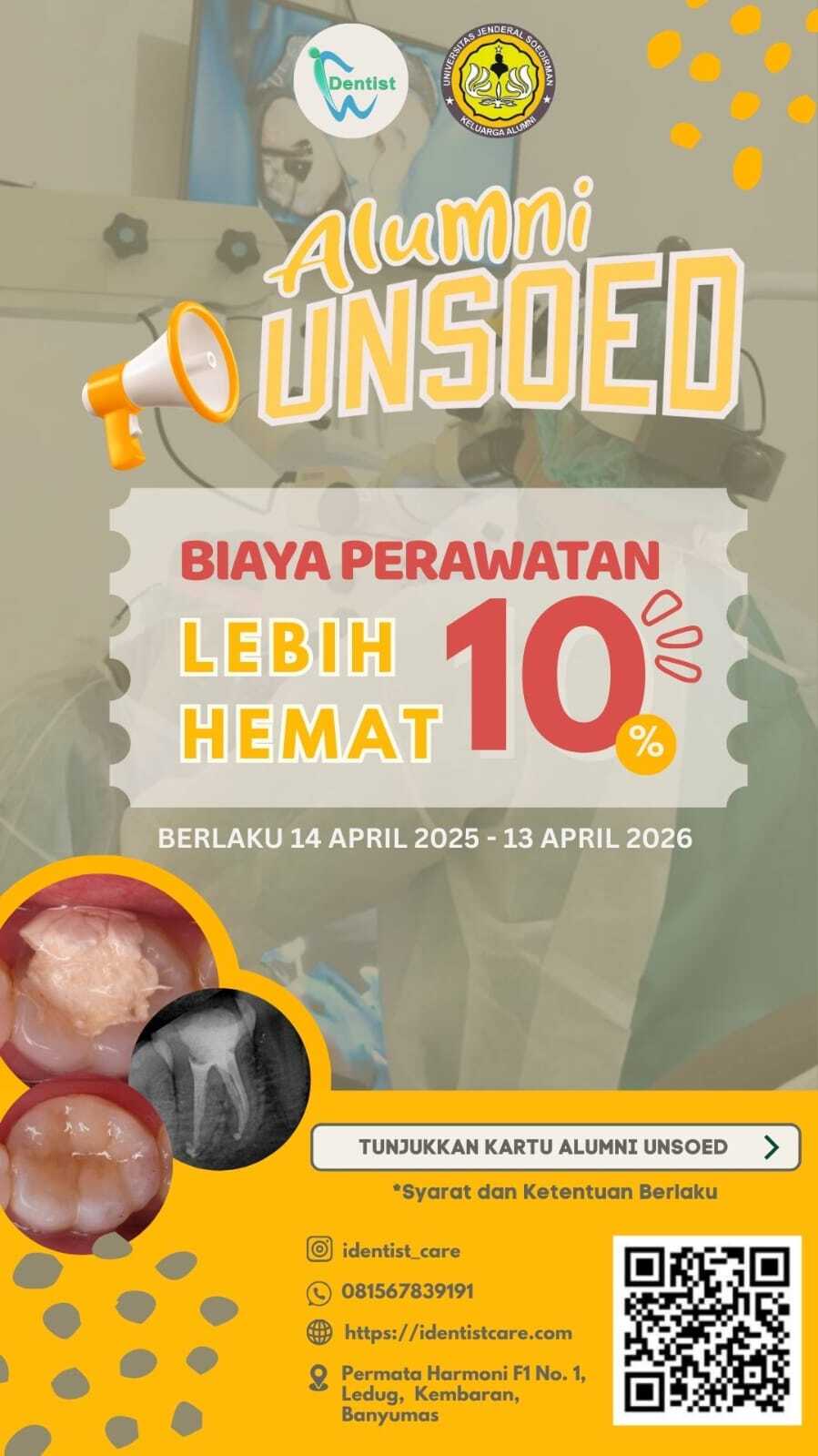 Biaya Perawatan Gigi Lebih Hemat 10% untuk Alumni Unsoed di Identist Care